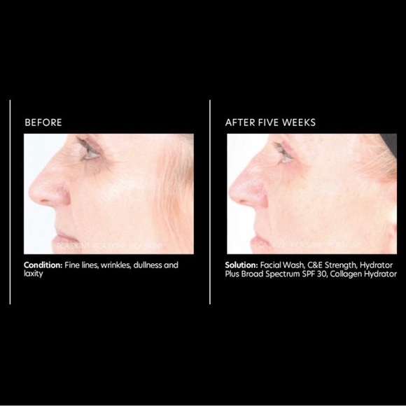 PCA Skin C&E Strength Max New - Picture 6 of 10